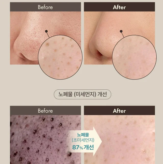 OBgE - 茶樹控油去黑頭棒 黑頭磨砂膏 (20g) OBgE Blackhead Scrub Balm【平行進口】